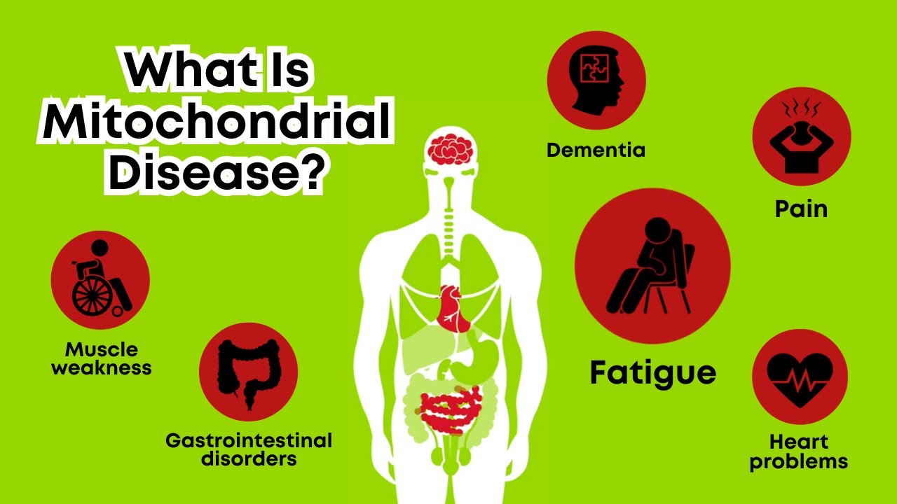 maxresdefault