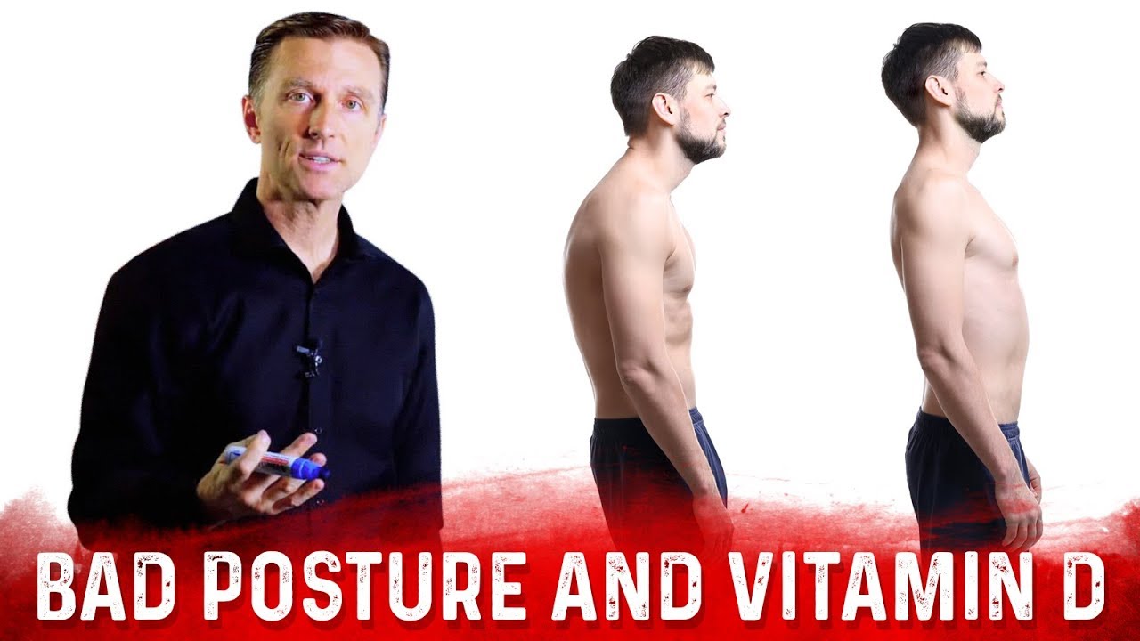 Is your poor posture linked to a vitamin D deficiency? (video)