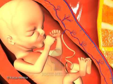 Syphilis - YouTube