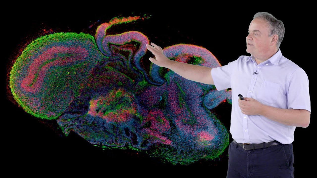 Jurgen Knoblich (IMBA) 2: Modeling Human Brain Development in 3D Organoid Culture - YouTube